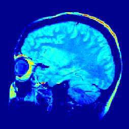 Rob's brain